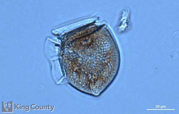 Photo of Dinophysis acuta/Dinophysis norvegica